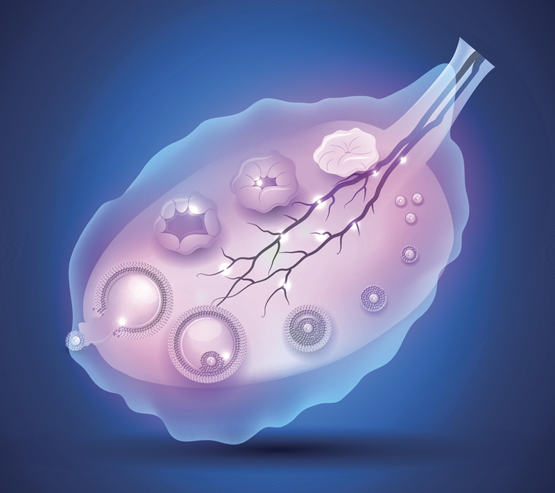 试管婴儿应该如何选择促排方案？